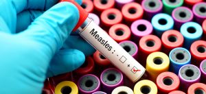 Measles Vaccine